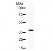 Western blot testing of recombinant human protein with DKK1 antibody. Predicted molecular weight: 26-40 kDa depending on glycosylation level.