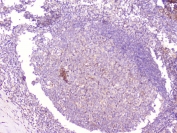 IHC staining of FFPE human tonsil tissue with CD1b antibody at 1ug/ml. HIER: boil tissue sections in pH6, 10mM citrate buffer, for 10-20 min followed by cooling at RT for 20 min.
