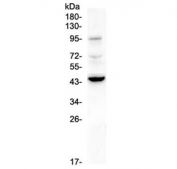 Western blot testing of human A375 cell lysate with CD72 antibody at 0.5ug/ml. Expected molecular weight: 39-45 kDa (monomer), ~86 kDa (dimer).