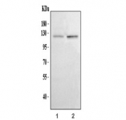 Western blot testing of human 1) A431 and 2) HaCaT cell lysate with CDH3 antibody. Expected molecular weight: ~91 kDa (unmodified), 100~130 kDa (glycosylated).
