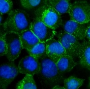 Immunofluorescent staining of FFPE human A431 cells with CDH3 antibody (green) and DAPI nuclear stain (blue). HIER: steam section in pH6 citrate buffer for 20 min.