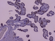 IHC staining of FFPE human placenta with Capicua antibody at 1ug/ml. HIER: boil tissue sections in pH6, 10mM citrate buffer, for 10-20 min followed by cooling at RT for 20 min.