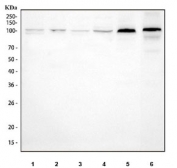 Western blot testing of 1) human HepG2, 2) human HaCaT, 3) human Caco-2, 4) human 293T, 5) rat cartilage and 6) mouse cartilage tissue lysate with COMP antibody at 0.5ug/ml. Expected molecular weight: 83-100 kDa depending on glycosylation level.