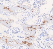 IHC staining of FFPE rat knee joint tissue with COMP antibody. HIER: boil tissue sections in pH8 EDTA for 20 min and allow to cool before testing.