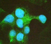 Immunofluorescent staining of FFPE human HepG2 cells with COMP antibody (green) and DAPI nuclear stain (blue). HIER: steam section in pH6 citrate buffer for 20 min.