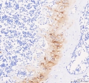 Immunofluorescent staining of FFPE human HepG2 cells with COMP antibody (green) and DAPI nuclear stain (blue). HIER: steam section in pH6 citrate buffer for 20 min.