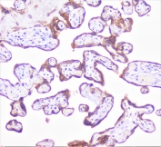 IHC staining of FFPE human placenta with COMP antibody at 1ug/ml. HIER: boil tissue sections in pH6, 10mM citrate buffer, for 10-20 min followed by cooling at RT for 20 min.