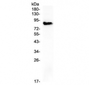 Western blot testing of human placenta with COMP antibody at 0.5ug/ml. Expected molecular weight: 83-100 kDa depending on glycosylation level.