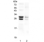 Western blot testing of 1) mouse liver and 2) mouse stomach lysate with COMT antibody at 0.5ug//ml. Predicted molecular weight: ~30/25 kDa (isoforms 1/2).