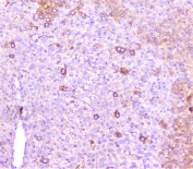 IHC staining of FFPE mouse liver with C Reactive Protein antibody at 1ug/ml. HIER: boil tissue sections in pH6, 10mM citrate buffer, for 10-20 min followed by cooling at RT for 20 min.