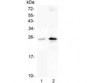Western blot testing of human 1) U-937 and 2) A431 cell lysate with C Reactive Protein antibody at 0.5ug/ml. Predicted molecular weight ~26 kDa.