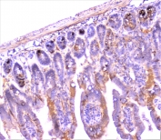 IHC staining of FFPE mouse small intestine with C Reactive Protein antibody at 1ug/ml. HIER: boil tissue sections in pH6, 10mM citrate buffer, for 10-20 min followed by cooling at RT for 20 min.