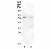 Western blot testing of human 1) placenta and 2) 293T lysate with CSF1 antibody at 0.5ug/ml. Predicted molecular weight ~60 kDa.