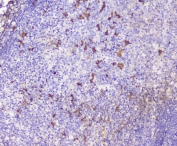 IHC staining of FFPE human tonsil with CXCL12 antibody at 0.5ug/ml. HIER: boil tissue sections in pH6, 10mM citrate buffer, for 10-20 min followed by cooling at RT for 20 min.