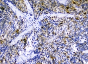 IHC staining of FFPE rat spleen with CXCL12 antibody at 0.5ug/ml. HIER: boil tissue sections in pH6, 10mM citrate buffer, for 10-20 min followed by cooling at RT for 20 min.