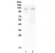 Western blot testing of 1) rat kidney and 2) mouse kidney lysate with DDR2 antibody at 0.5ug/ml. Predicted molecular weight: 97-116 kDa.