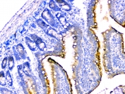 IHC staining of FFPE rat small intestine with DDR2 antibody at 2ug/ml. HIER: boil tissue sections in pH6, 10mM citrate buffer, for 10-20 min followed by cooling at RT for 20 min.
