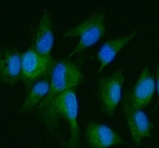 IHC staining of FFPE mouse small intestine with DDR2 antibody at 2ug/ml. HIER: boil tissue sections in pH6, 10mM citrate buffer, for 10-20 min followed by cooling at RT for 20 min.