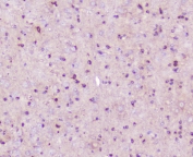 IHC staining of FFPE mouse brain tissue with ELAVL2 antibody at 1ug/ml. HIER: boil tissue sections in pH6, 10mM citrate buffer, for 10-20 min followed by cooling at RT for 20 min.