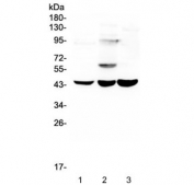 Western blot testing of human 1) T-47D, 2) A549 and 3) Caco-2 lysate with ELAVL2 antibody at 0.5ug/ml. Predicted molecular weight ~40 kDa.