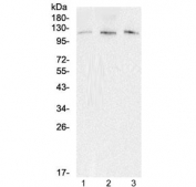 Western blot testing of 1) rat brain, 2) mouse brain, 3) mouse lung lysate with EML4 antibody at 0.5ug/ml. Expected molecular weight: 108-120 kDa.