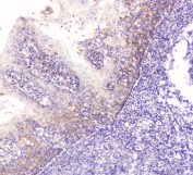 IHC staining of FFPE human tonsil with EML4 antibody at 1ug/ml. HIER: boil tissue sections in pH6, 10mM citrate buffer, for 10-20 min followed by cooling at RT for 20 min.