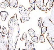 IHC staining of FFPE human placental tissue with EML4 antibody. HIER: boil tissue sections in pH8 EDTA for 20 min and allow to cool before testing.