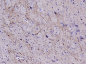 IHC staining of FFPE mouse brain with NSE antibody at 1ug/ml. HIER: boil tissue sections in pH6, 10mM citrate buffer, for 10-20 min followed by cooling at RT for 20 min.