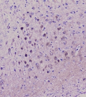 IHC staining of FFPE rat brain with NSE antibody at 1ug/ml. HIER: boil tissue sections in pH6, 10mM citrate buffer, for 10-20 min followed by cooling at RT for 20 min.