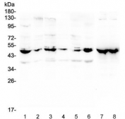 Western blot testing of human 1) 22RV1, 2) U-2 OS, 3) A431, 4) HepG2, 5) A549, 6) SHG-44, 7) rat brain and 8) mouse brain lysate with NSE antibody at 0.5ug/ml. Predicted molecular weight ~47 kDa.