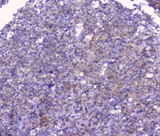 IHC staining of FFPE human tonsil tissue with CD32 antibody at 1ug/ml. HIER: boil tissue sections in pH6, 10mM citrate buffer, for 10-20 min followed by cooling at RT for 20 min.