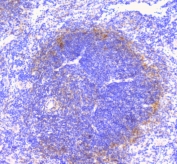 IHC staining of FFPE mouse spleen with CD32 antibody at 1ug/ml. HIER: boil tissue sections in pH6, 10mM citrate buffer, for 10-20 min followed by cooling at RT for 20 min.