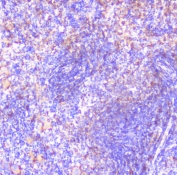 IHC staining of FFPE rat spleen with CD32 antibody at 1ug/ml. HIER: boil tissue sections in pH6, 10mM citrate buffer, for 10-20 min followed by cooling at RT for 20 min.