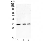 Western blot testing of 1) K562, 2) Caco-2 and 3) U-2 OS cell lysate with CD32 antibody at 0.5ug/ml. Predicted molecular weight: 34-40 kDa depending on the level of glycosylation.