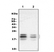 Western blot testing of human 1) SK-OV-3 and 2) HeLa cell lysate with FGF2 antibody. Predicted molecular weight: 17-31 kDa (multiple isoforms).