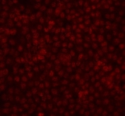 Immunofluorescent staining of FFPE human A431 cells with FGF2 antibody. HIER: steam section in pH6 citrate buffer for 20 min.