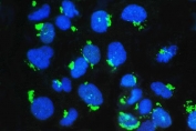 Western blot testing of human 1) placenta, 2) A549, 3) K562, 4) HL-60, 5) MCF-7 and 6) Caco-2 cell lysate with GM130 antibody at 0.5ug/ml. Predicted molecular weight ~130 kDa.