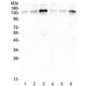 Western blot testing of human 1) placenta, 2) A549, 3) K562, 4) HL-60, 5) MCF-7 and 6) Caco-2 cell lysate with GM130 antibody at 0.5ug/ml. Predicted molecular weight ~130 kDa.