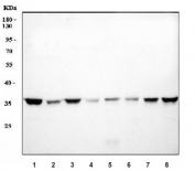 Western blot testing of 1) human HeLa, 2) human 293T, 3) human MDA-MB-453, 4) human A431, 5) rat lung, 6) rat testis, 7) mouse lung and 8) mouse testis lysate with GOLPH3 antibody at 0.5ug/ml. Predicted molecular weight ~34 kDa.