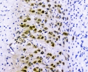 IHC staining of FFPE rat brain tissue with GOLPH3 antibody. HIER: boil tissue sections in pH8 EDTA for 20 min and allow to cool before testing.
