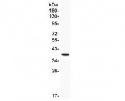 Western blot testing of human recombinant protein with TIM1 antibody. Predicted molecular weight~39 kDa, routinely observed at ~55 kDa (Ref 1), and a heavily glycosylated mature form at ~100 kDa (Ref 2).