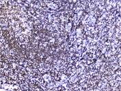 IHC staining of FFPE human tonsil tissue with HMGN2 antibody at 2ug/ml. HIER: boil tissue sections in pH6, 10mM citrate buffer, for 10-20 min followed by cooling at RT for 20 min.
