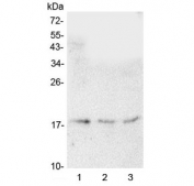Western blot testing of human 1) HeLa, 2) A549 and 3) U-87 MG cell lysate with HMGN2 antibody at 0.5ug/ml. Predicted molecular weight ~18 kDa.