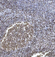 IHC staining of FFPE human tonsil tissue with HMGN2 antibody. HIER: boil tissue sections in pH8 EDTA for 20 min and allow to cool before testing.
