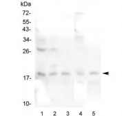 Western blot testing of 1) rat brain, 2) rat lung, 3) mouse brain, 4) mouse ovary and 5) mouse HEPA 1-6 lysate with IFNG antibody at 0.5ug/ml. Expected molecular weight: 19-24 kDa depending on glycosylation level.