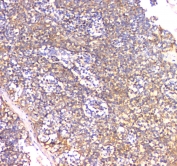 IHC staining of FFPE human tonsil tissue with IFNG antibody at 1ug/ml. HIER: boil tissue sections in pH6, 10mM citrate buffer, for 10-20 min and allow to cool before testing.