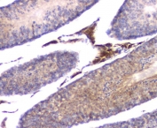 IHC staining of FFPE mouse testis tissue with IFNG antibody at 1ug/ml. HIER: boil tissue sections in pH6, 10mM citrate buffer, for 10-20 min and allow to cool before testing.