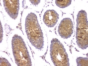 IHC staining of FFPE rat testis tissue with IFNG antibody at 1ug/ml. HIER: boil tissue sections in pH6, 10mM citrate buffer, for 10-20 min and allow to cool before testing.