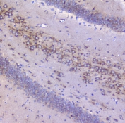 IHC staining of FFPE rat brain with Igf2r antibody at 1ug/ml. HIER: boil tissue sections in pH6, 10mM citrate buffer, for 10-20 min followed by cooling at RT for 20 min.