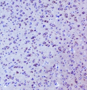 IHC staining of FFPE mouse brain with Igf2r antibody at 1ug/ml. HIER: boil tissue sections in pH6, 10mM citrate buffer, for 10-20 min followed by cooling at RT for 20 min.